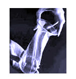 preservativi al femminile